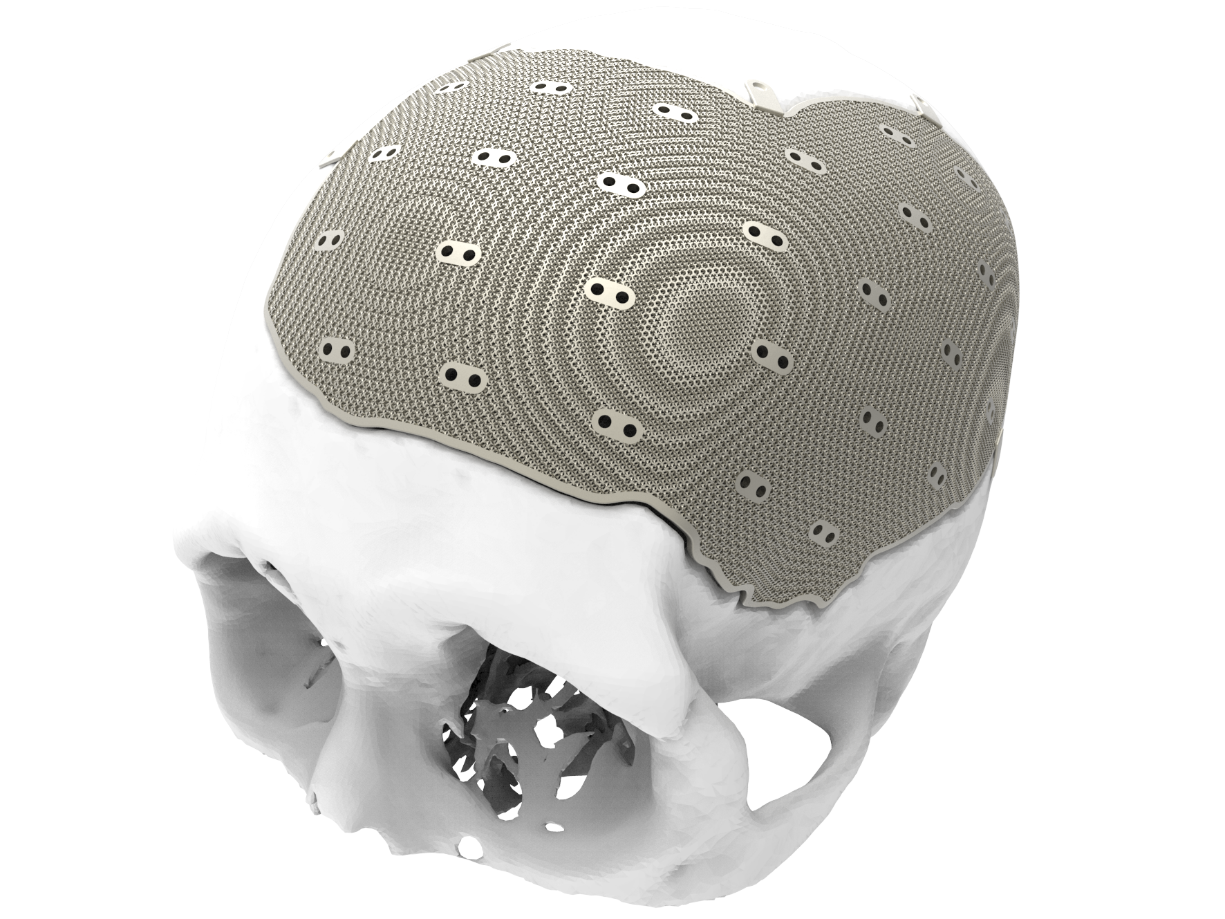 CAPSTAY
