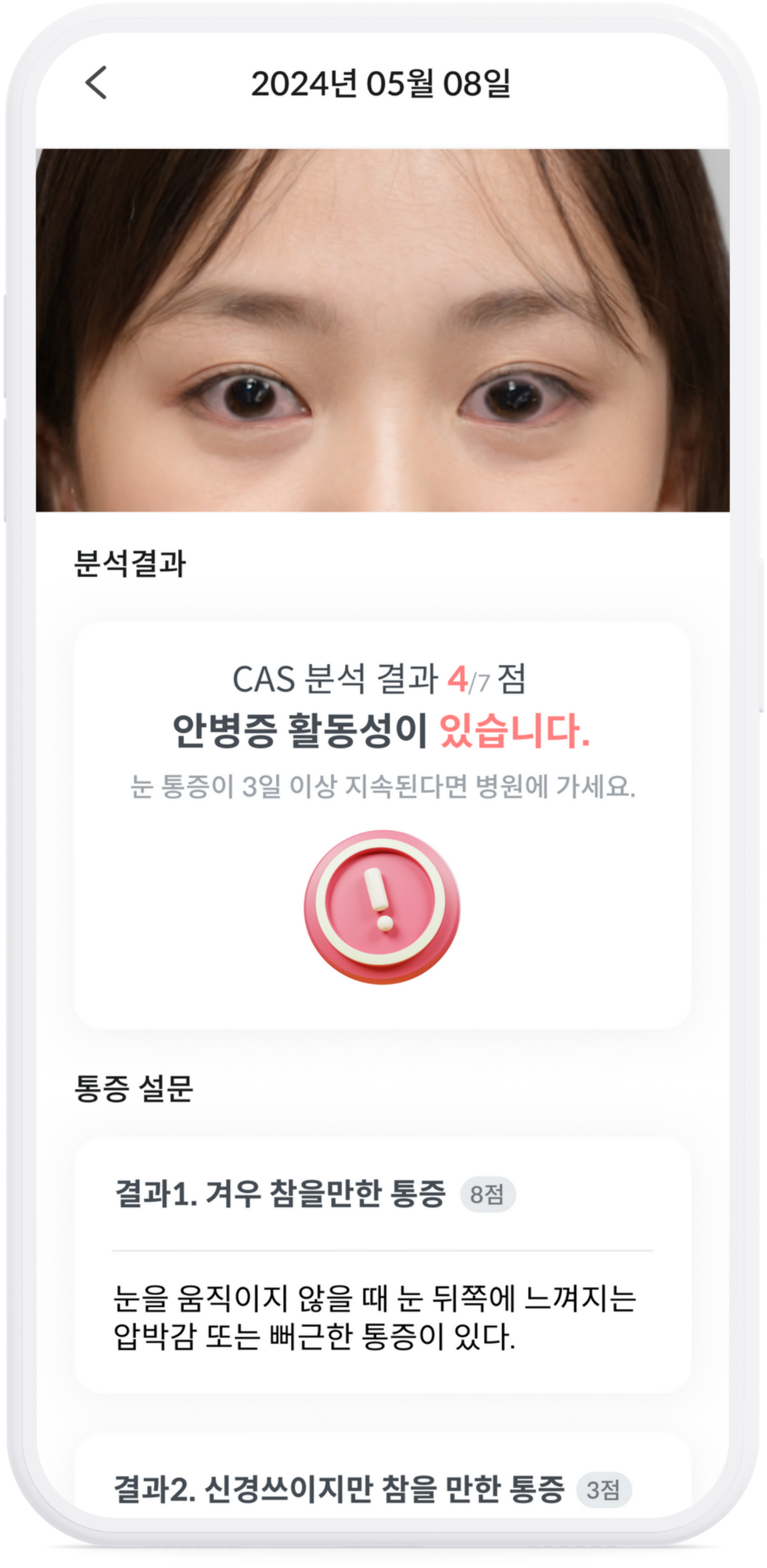 CAPSTAY